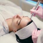 microneedling Toulouse