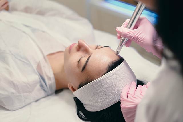 microneedling Toulouse